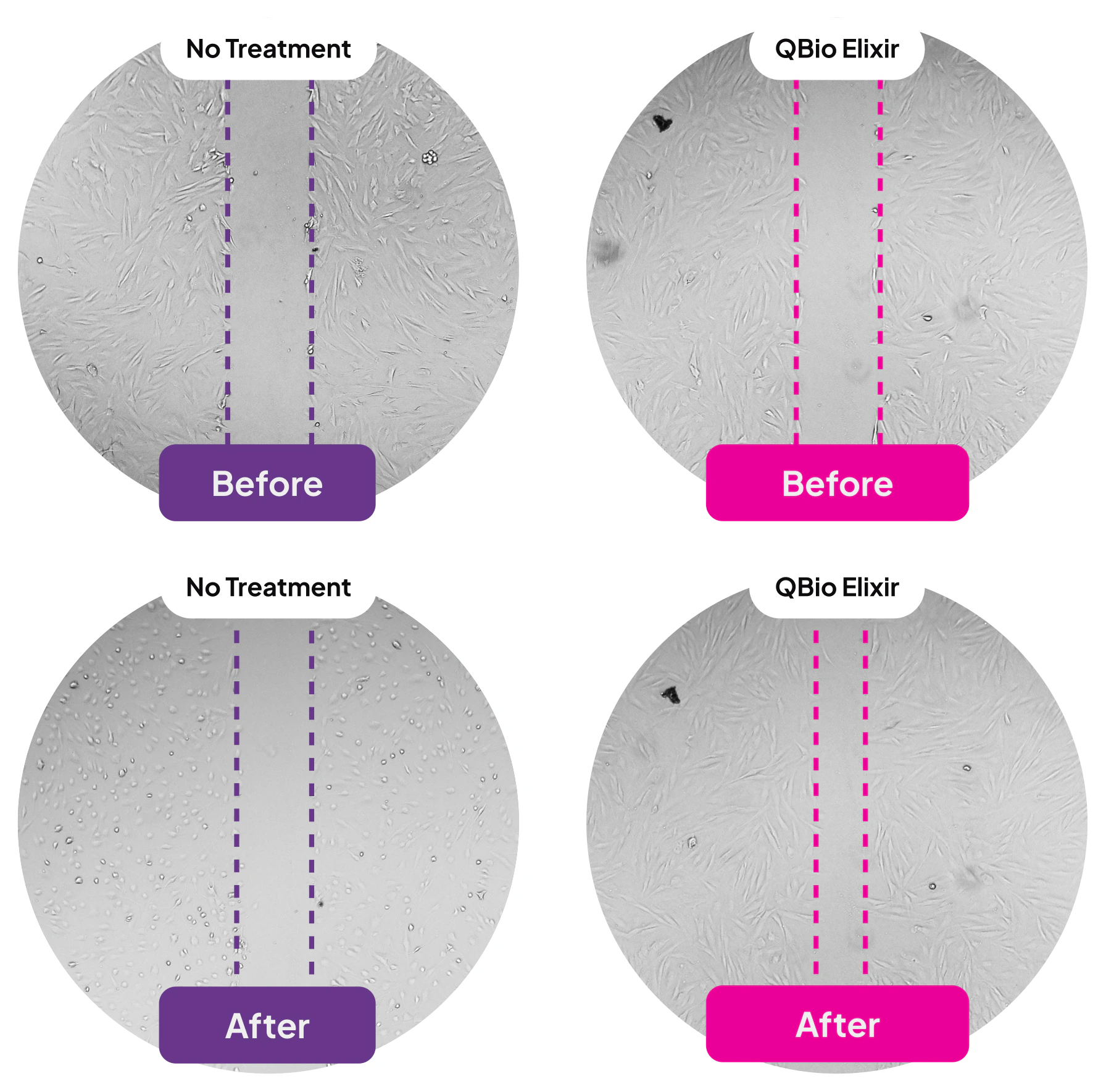 Phase contrast microscopy images showing the scratch gap in untreated control and QBio Elixir exposed fibroblast cultures before and after 12 hours, with a narrower gap in the QBio Elixir condition.