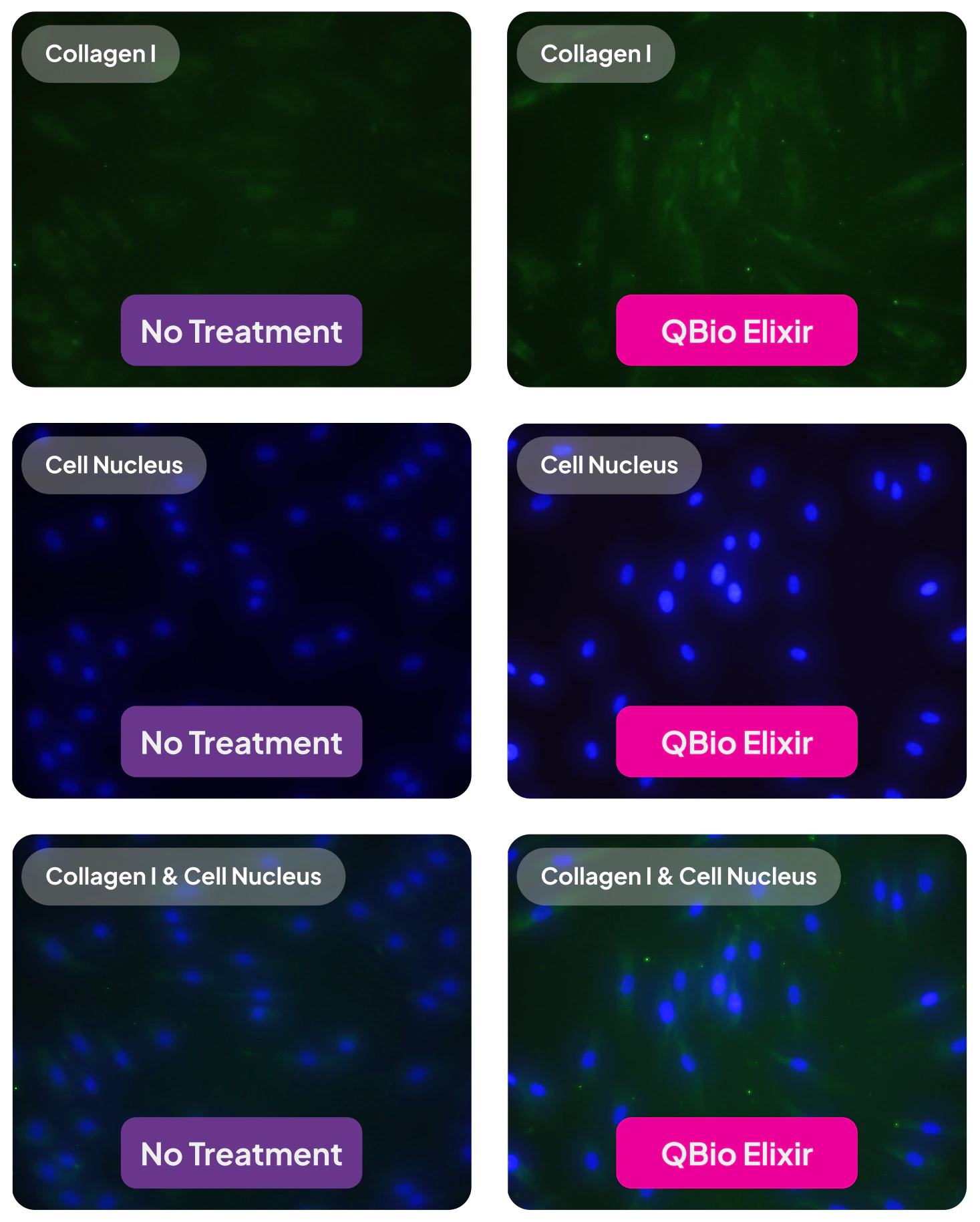 Fluorescence microscopy panels showing Collagen I staining, cell nuclei staining, and merged images for untreated control and QBio Elixir exposed fibroblasts, with brighter Collagen I signal in the QBio Elixir condition.